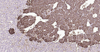 Rat CHGA Ready-To-Use IHC Kit