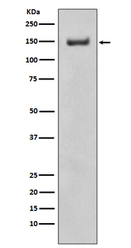 ROCK1 Recombinant Rabbit Monoclonal Antibody