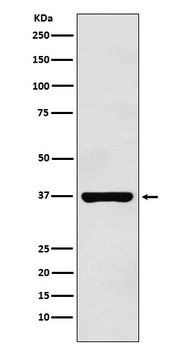 PIM2 Recombinant Rabbit Monoclonal Antibody