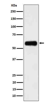 GM-CSFR alpha Recombinant Rabbit Monoclonal Antibody