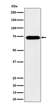 HnRNP M Recombinant Rabbit Monoclonal Antibody