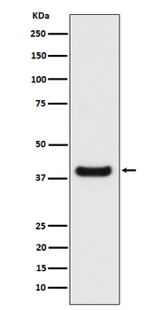 SPFH2 Recombinant Rabbit Monoclonal Antibody