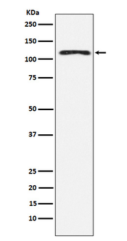 HLTF Recombinant Rabbit Monoclonal Antibody