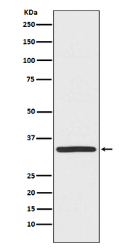 TRADD Recombinant Rabbit Monoclonal Antibody