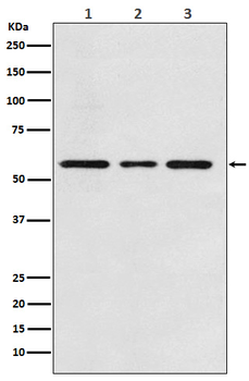 ACVRL1 Recombinant Rabbit Monoclonal Antibody