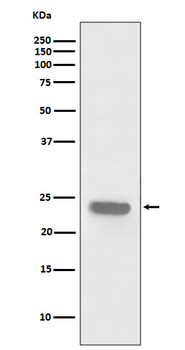PARK7/DJ1 Recombinant Rabbit Monoclonal Antibody