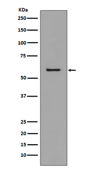 CCR3 Recombinant Rabbit Monoclonal Antibody