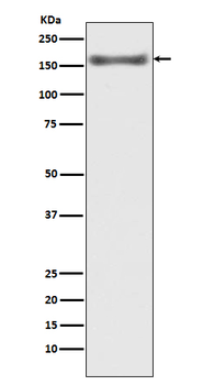 ASK1 Recombinant Rabbit Monoclonal Antibody