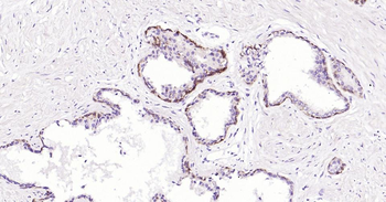 Cytokeratin 5 Mouse Monoclonal Antibody