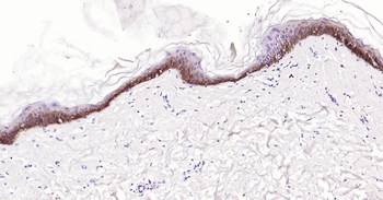 Cytokeratin 5 Mouse Monoclonal Antibody