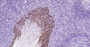 Cytokeratin 5 Mouse Monoclonal Antibody