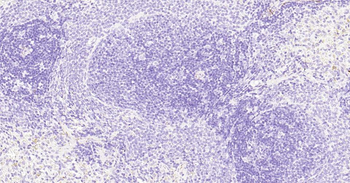 Tau-4 Mouse Monoclonal Antibody