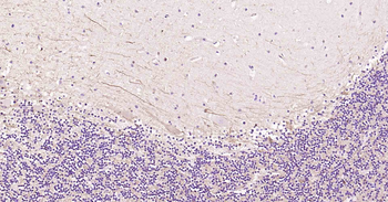 Tau-4 Mouse Monoclonal Antibody