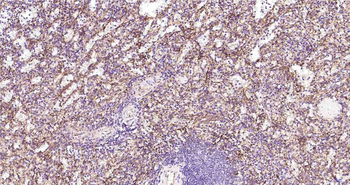 CD105 Recombinant Rabbit Monoclonal Antibody