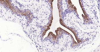 UPK3A Recombinant Rabbit Monoclonal Antibody