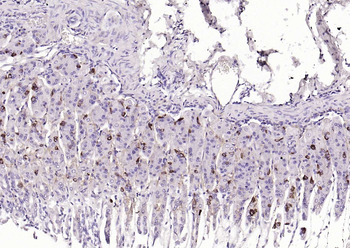CHGA Rabbit Polyclonal Antibody