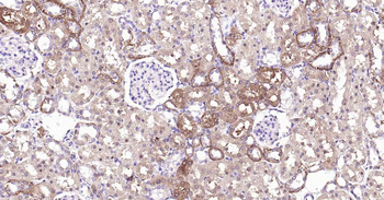 Beclin 1 Recombinant Rabbit Monoclonal Antibody