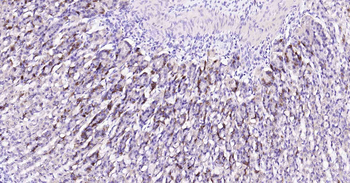 Beclin 1 Recombinant Rabbit Monoclonal Antibody