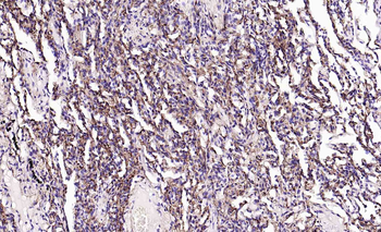 CD34 Recombinant Rabbit Monoclonal Antibody