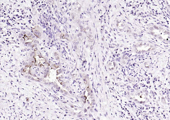 Mucin-1 Mouse Monoclonal Antibody