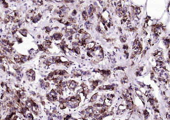 Mucin-1 Mouse Monoclonal Antibody
