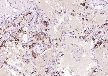 Mucin-1 Mouse Monoclonal Antibody