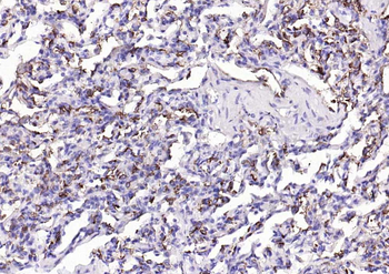 Mucin-1 Mouse Monoclonal Antibody