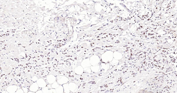 PCNA Rabbit Polyclonal Antibody