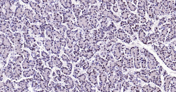 PCNA Rabbit Polyclonal Antibody