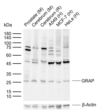 GRAP Rabbit Polyclonal Antibody