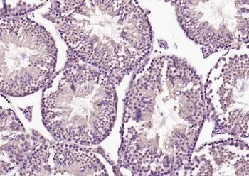 FBXL5 Rabbit Polyclonal Antibody
