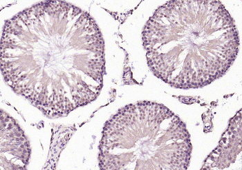 FBXL5 Rabbit Polyclonal Antibody