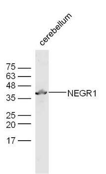 NEGR1 Rabbit Polyclonal Antibody