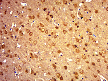 KRCC1 Rabbit Polyclonal Antibody