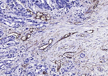 CD105 Rabbit Polyclonal Antibody