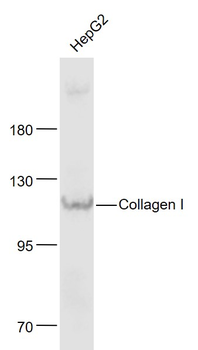 Collagen I Rabbit Polyclonal Antibody