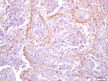 Collagen I Rabbit Polyclonal Antibody