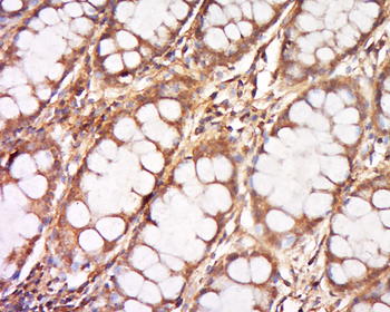DNCLI1 Rabbit Polyclonal Antibody