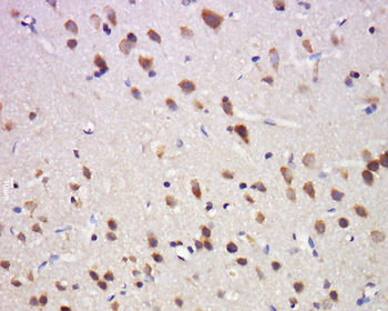 Phospho-delta Opioid Receptor (Ser363) Rabbit Polyclonal Antibody