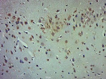 LOX 1 Rabbit Polyclonal Antibody