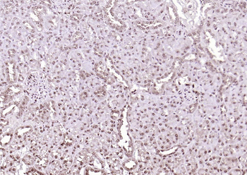 PSMD14 Rabbit Polyclonal Antibody