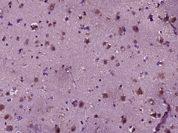 PRKACA Rabbit Polyclonal Antibody