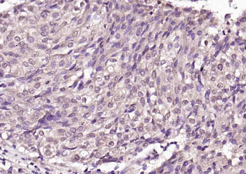 PRKACA Rabbit Polyclonal Antibody
