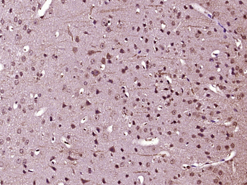 PRKACA Rabbit Polyclonal Antibody