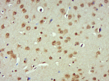 PARN Rabbit Polyclonal Antibody