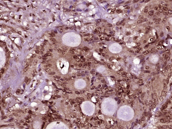 PRKRIR Rabbit Polyclonal Antibody