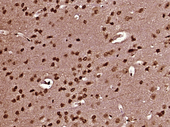 PRKRIR Rabbit Polyclonal Antibody
