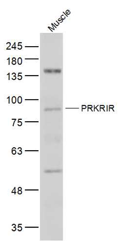 PRKRIR Rabbit Polyclonal Antibody