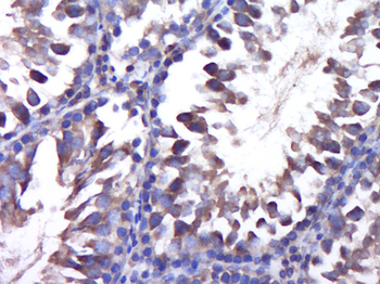 PPP3CC Rabbit Polyclonal Antibody
