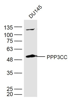 PPP3CC Rabbit Polyclonal Antibody